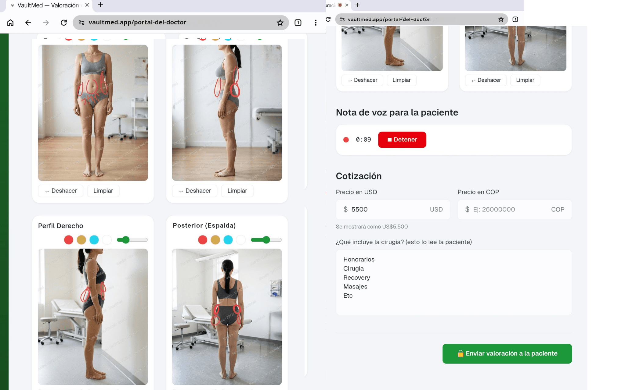 Detalle de un caso: las fotos con las zonas marcadas a mano en rojo, el grabador de la nota de voz para la paciente y el formulario de cotización con el precio y lo que incluye la cirugía.